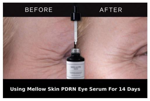 Mellow Skin Polynucleotide (Salmon DNA - PDRN) Restore & Hydrating Eye Serum With Polynucleotides, Hyaluronic Acid & Spilanthes (30ml)